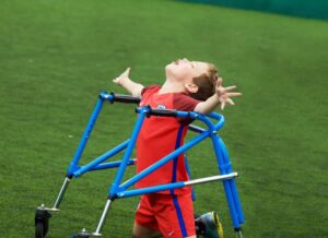 Serebral Palsi Belirtileri